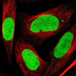 LEDGF Antibody, Novus Biologicals 25 &mu;L; Unlabeled:Antibodies, Polyclonal